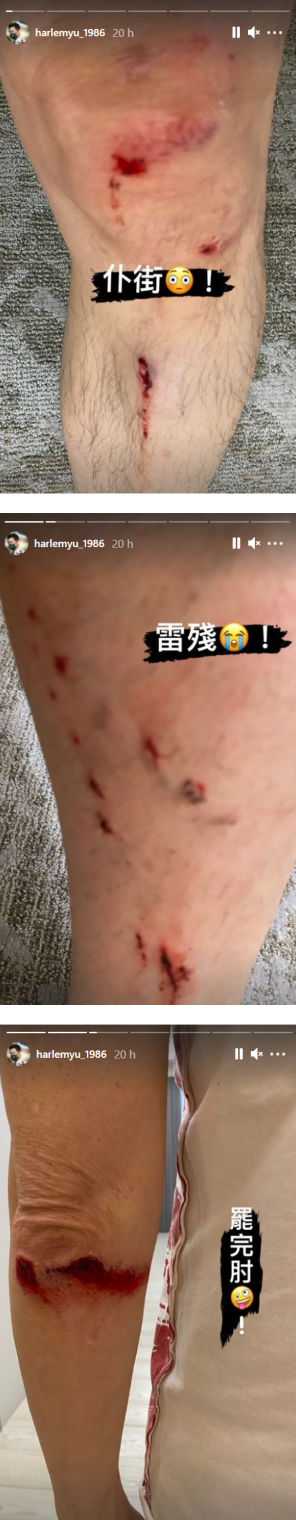 60岁庾澄庆骑车出意外！手肘、膝盖、手掌见血...粉丝吓傻 娱乐资讯 图1张