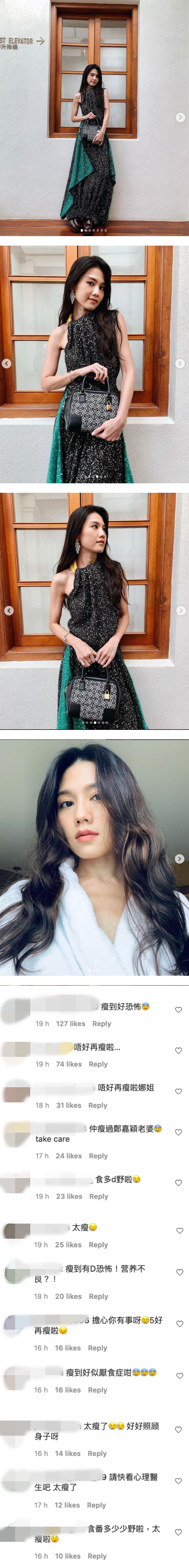 巨胸“缩水”后…周秀娜再献恐怖“火柴手” ！网惊：瘦到好像厌食症 娱乐资讯 图2张