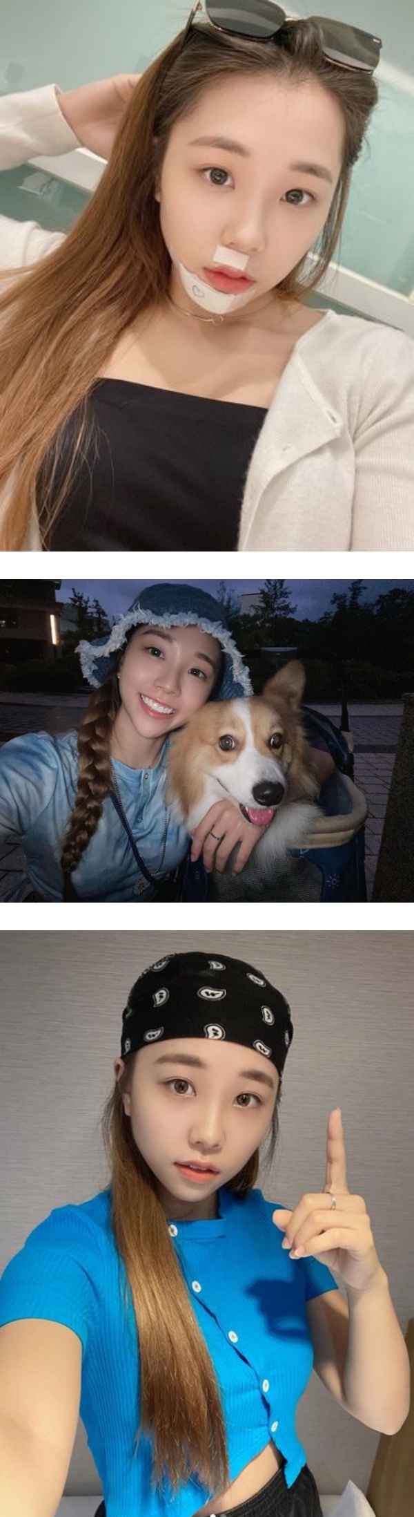 艾薇脸部再受重伤！鼻下+下巴有伤口 吓坏粉丝 娱乐资讯 图2张