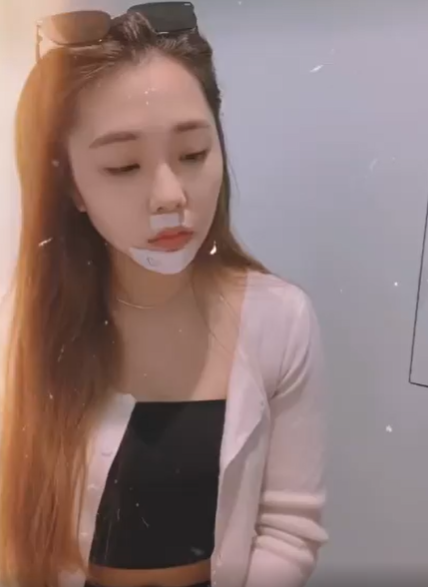 艾薇脸部再受重伤！鼻下+下巴有伤口 吓坏粉丝 娱乐资讯 图1张