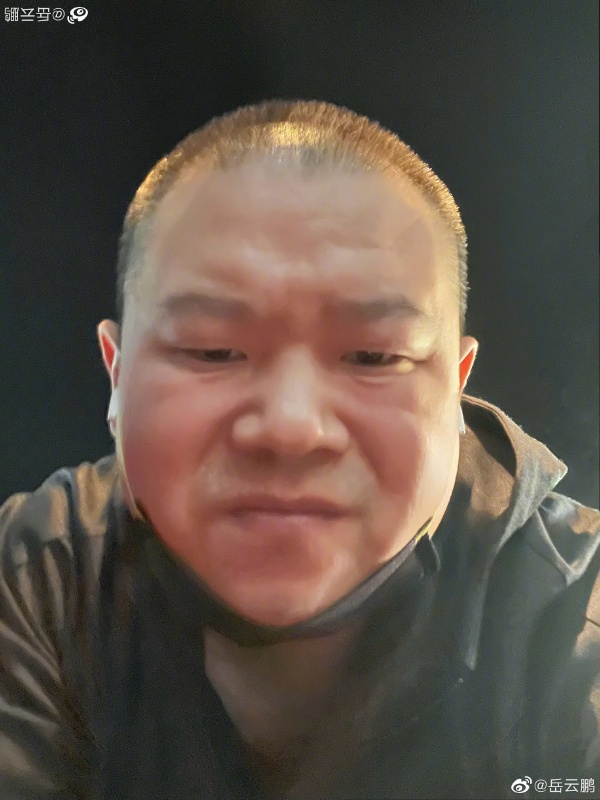 36岁岳云鹏“暴瘦+剃光头”疯传病危！曾透露：身体不舒服 娱乐资讯 图4张