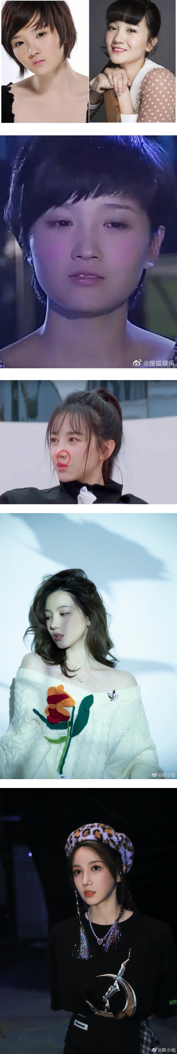 陈小纭晒素颜照气质满满！自曝曾整容超过十次 “真的非常疼” 娱乐资讯 图3张