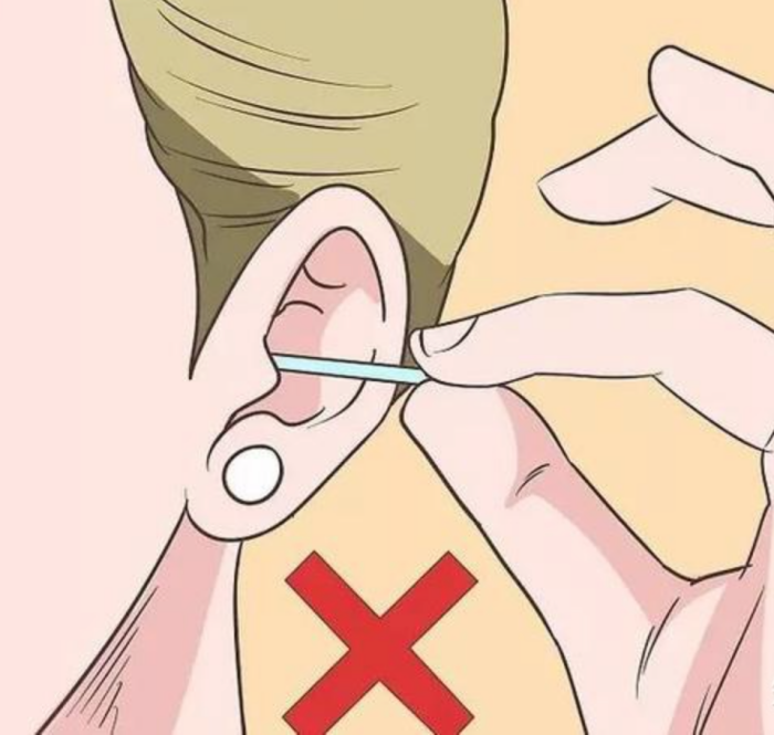 Tips｜耳朵痒是有人想你？真是想多了，是这5个原因才对！ 更多热点 图2张