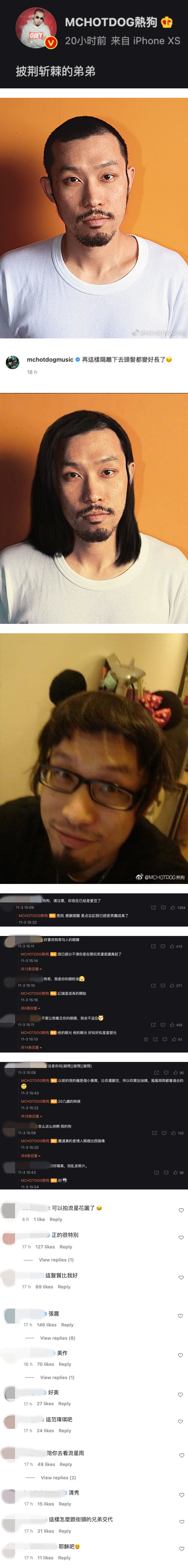 热狗晒出光头+长发旧照自嘲“弟弟” ！网调侃：别忘了你现在已经是爱豆 娱乐资讯 图2张