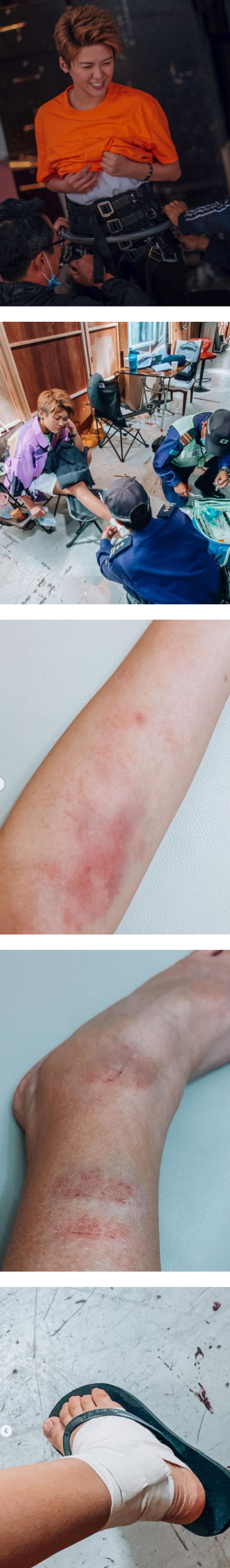 江嘉敏连续2星期通宵...身体熬不住！被担架床抬出厂吸氧 娱乐资讯 图1张