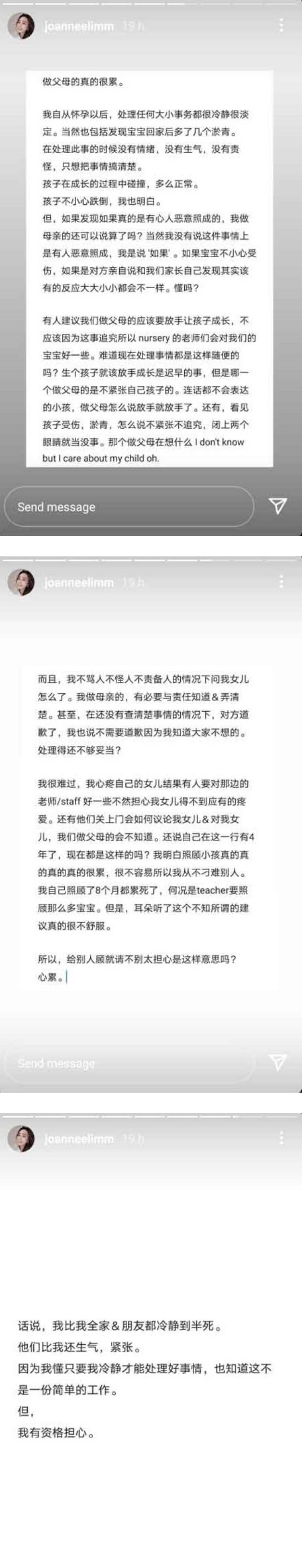 8月大女儿幼儿园回家后 手脚惊现不明瘀伤！吕锐担心女儿被欺负 娱乐资讯 图2张