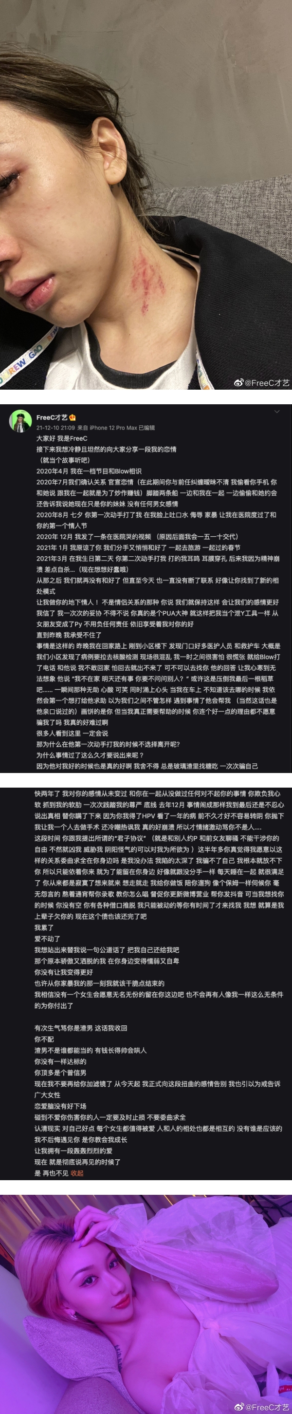 《新说唱》选手Blow Fever承认动手打女友！“出于惧怕，被迫还手” 娱乐资讯 图2张