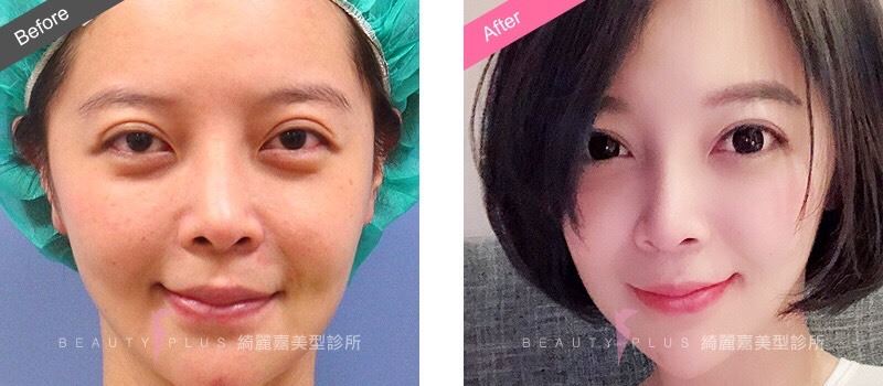把握冬天微调好时机！美女书法家分享眼睛“再进化”的秘密 时尚资讯 图3张