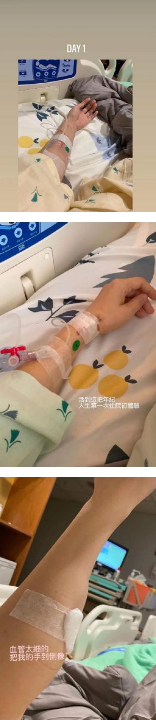 陈乔恩住院...手臂肿成“鸡腿”！马来西亚男友买花陪床 娱乐资讯 图1张