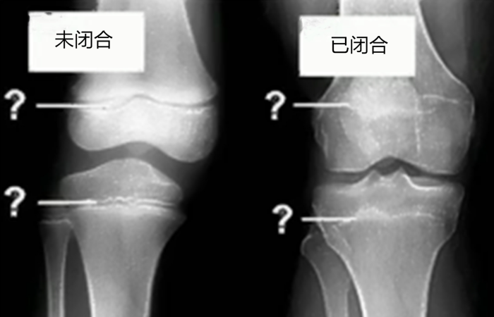 生活｜怀孕居然会长高？会二次长高的主要原因是这两个！ 更多热点 图1张