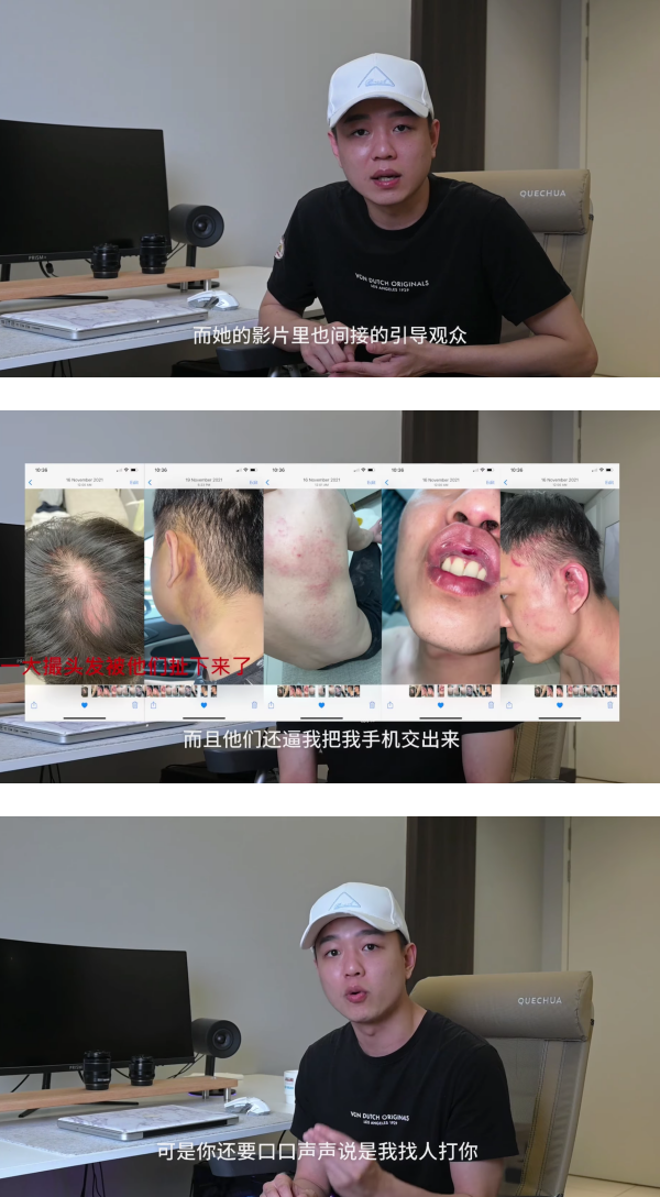 Chris 指控杨宝贝贼喊抓贼…真正被打的人是自己！公布关键证据后网惊：毁三观！ 娱乐资讯 图2张