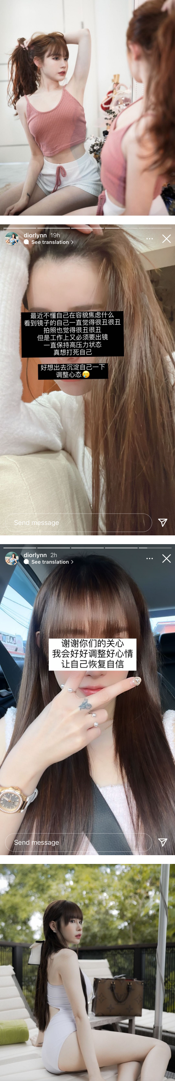 Diorlynn 自曝患上容貌焦虑症 ！“看到镜子里的自己觉得很丑” 娱乐资讯 图2张