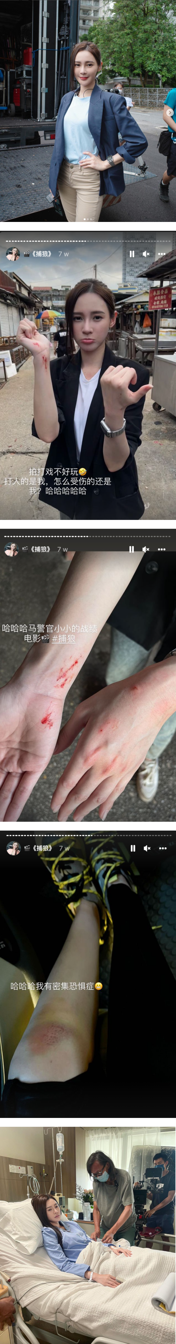 Yumi 黄诗棋跑宣传遇车祸！状况曝光了 娱乐资讯 图3张