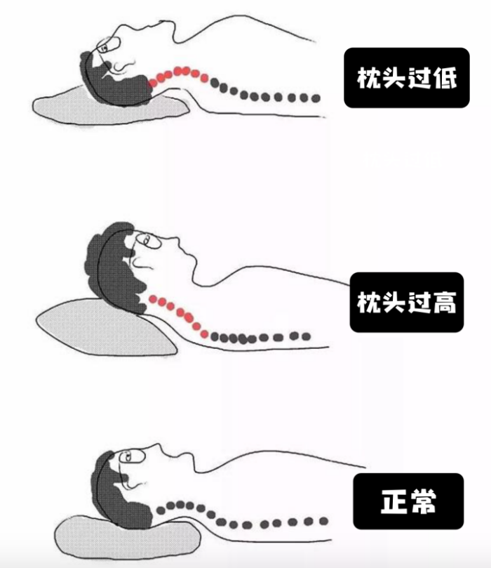 Tips｜记忆枕是不是智商税？好睡的枕头挑选看这4招 更多热点 图3张