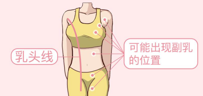 生活｜副乳也会有乳腺癌？出现这3种情况女生们可要注意了！ 更多热点 图1张