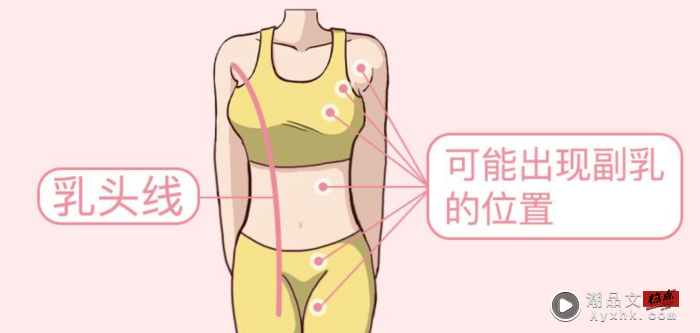 生活｜副乳也会有乳腺癌？出现这3种情况女生们可要注意了！ 更多热点 图1张