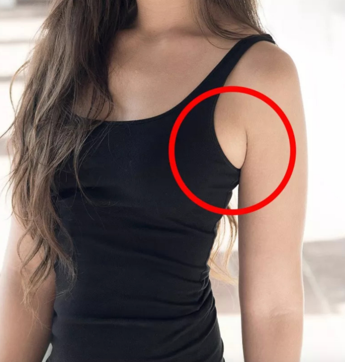 生活｜副乳也会有乳腺癌？出现这3种情况女生们可要注意了！ 更多热点 图3张