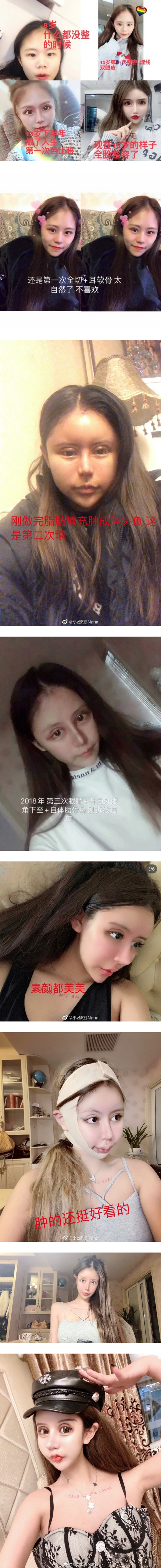 18岁网红3年整容60次！“身材和脸蛋才是自己最好的奢侈品” 娱乐资讯 图2张