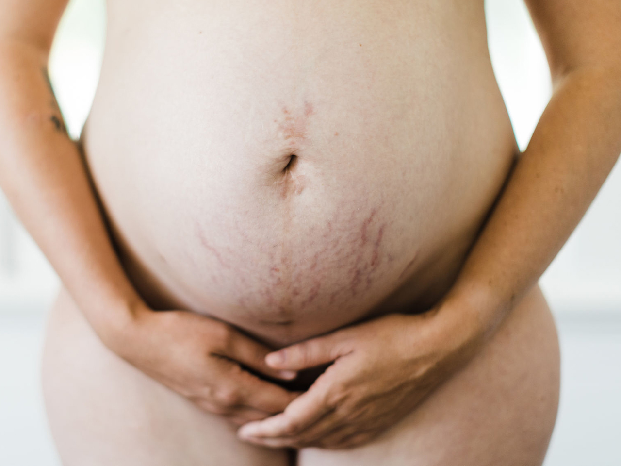 生活 | 90%孕妇的困扰！3大方法减少妊娠纹 不花钱也能解决！ 更多热点 图2张