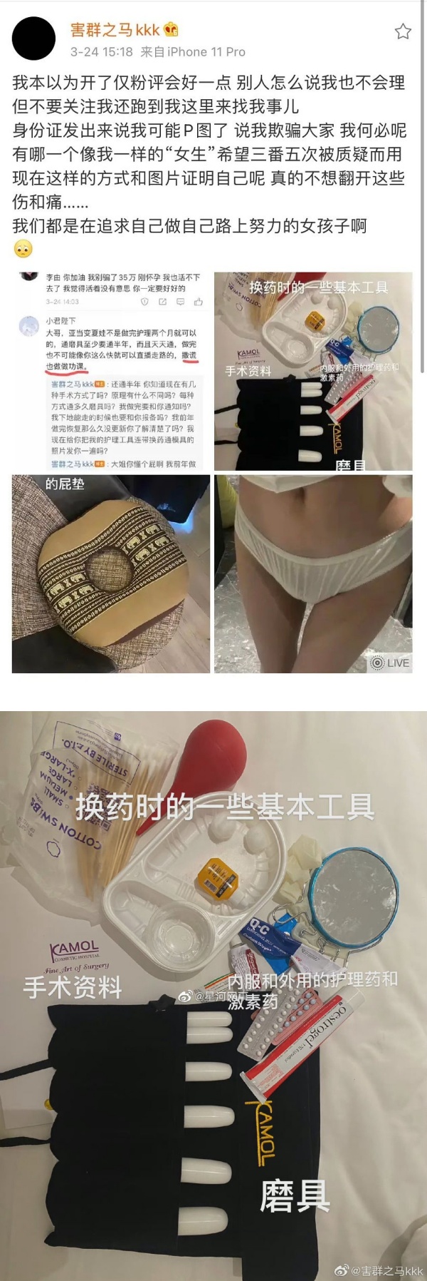 网红动变性手术...从男儿身→美女！晒下身照“证明自己” 娱乐资讯 图2张