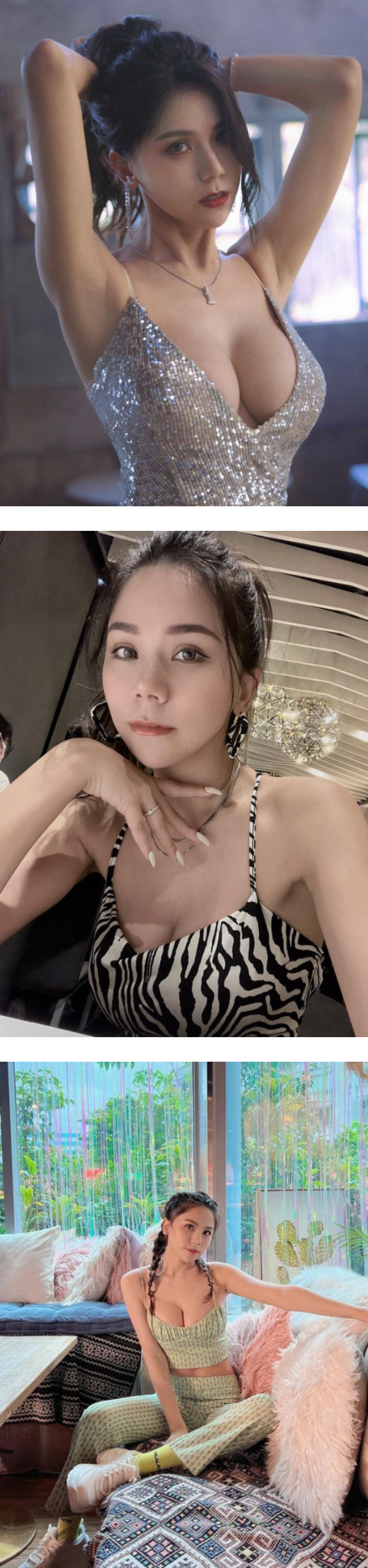 蕾菈动抽脂手术！“脸肿成猪头”维持1个月！ 娱乐资讯 图3张