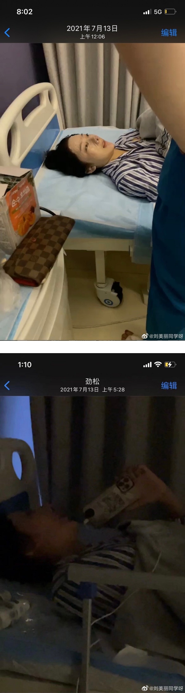 素颜照疯传全网...都美竹再被曝光整容照！花5位数动鼻子、下巴 娱乐资讯 图1张