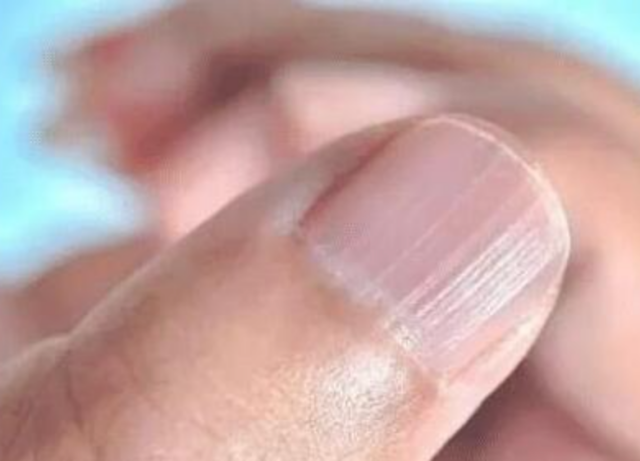 健康｜贫血最多只是头晕？小心慢性病、免疫力下降都会找上你！ 更多热点 图1张