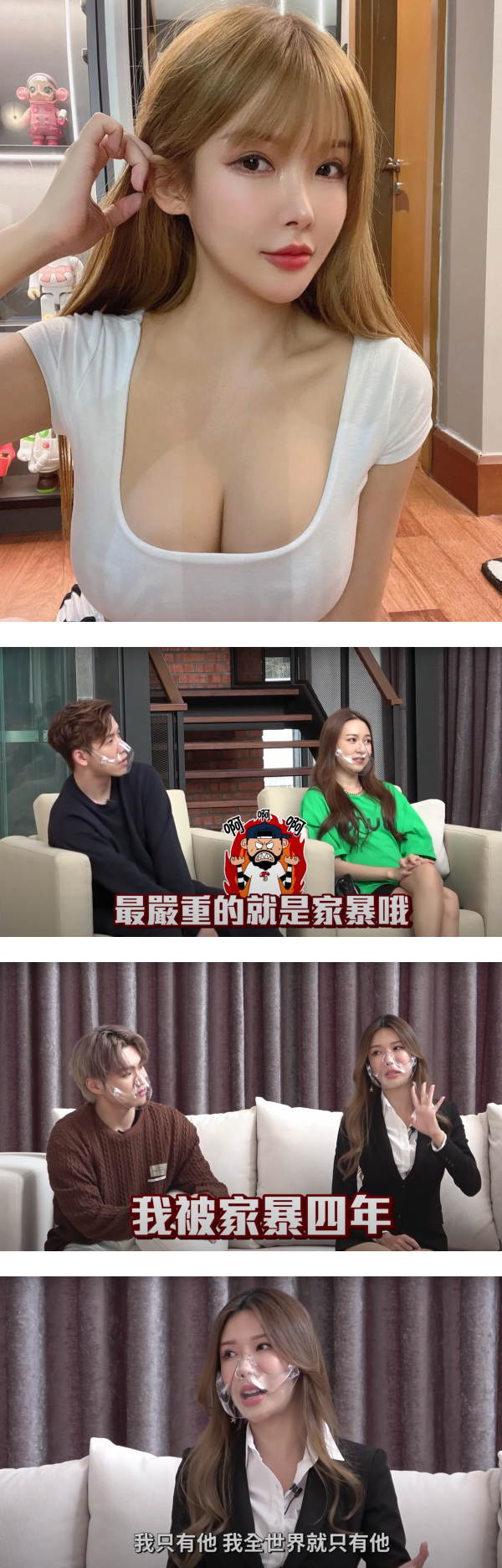 Gatita 自曝曾被前男友家暴4年！打到一只脚跛掉…另一只脚严重淤青 娱乐资讯 图2张