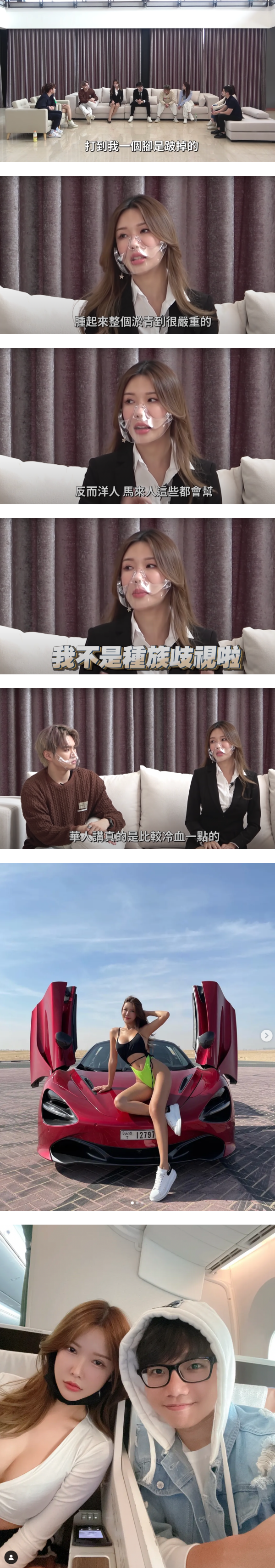 Gatita 自曝曾被前男友家暴4年！打到一只脚跛掉…另一只脚严重淤青 娱乐资讯 图3张
