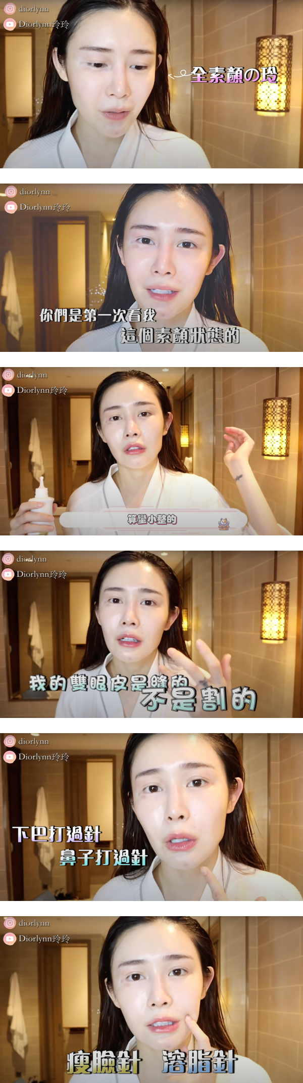 Diorlynn大方承认“微整形”…分享动刀细节！首度全素颜亮相 娱乐资讯 图2张