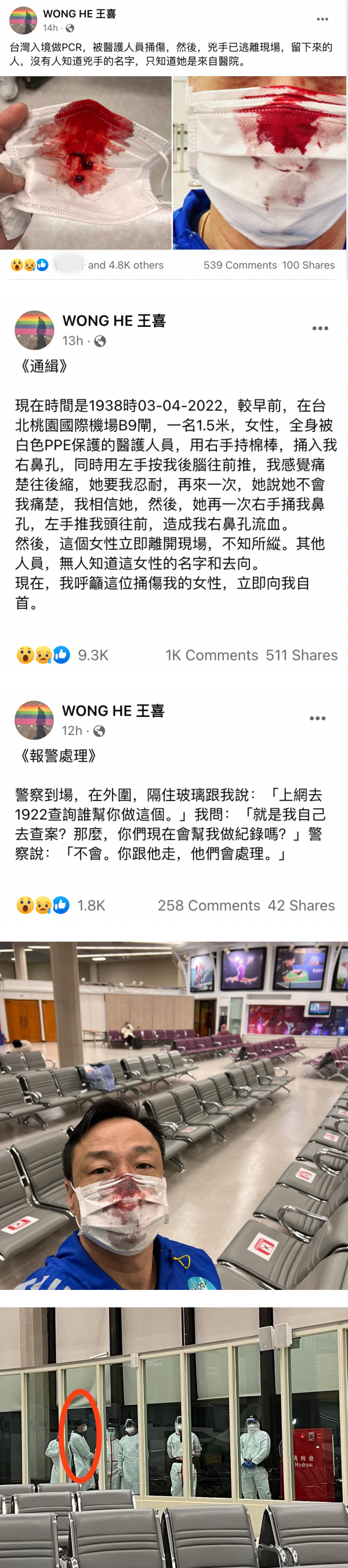 王喜入境中国台湾做PCR被捅伤…鼻孔鲜血狂喷！气到直接报警 娱乐资讯 图2张