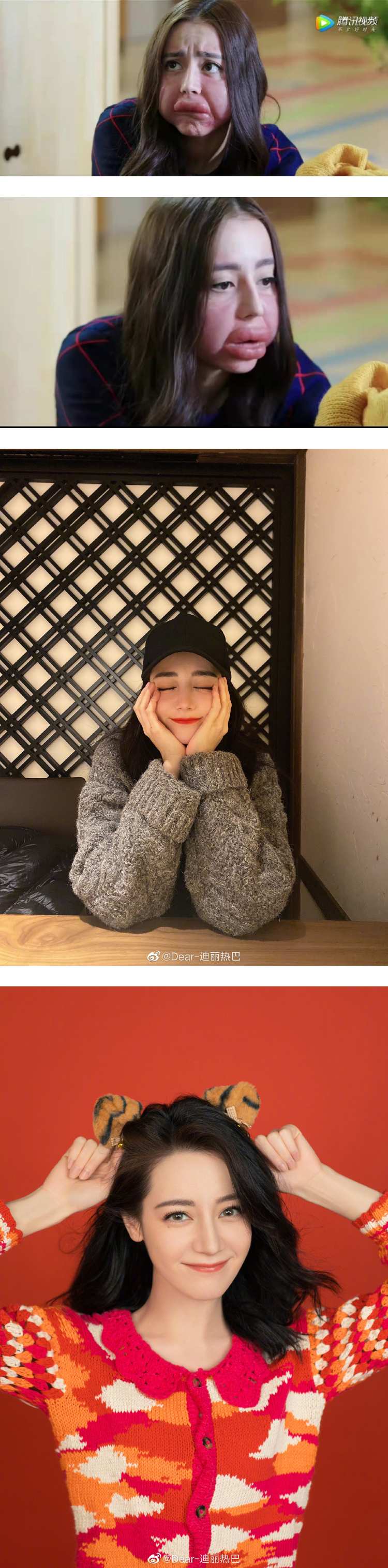 绝世美颜崩坏了！ 迪丽热巴肿成猪头+香肠嘴...网全看傻 娱乐资讯 图2张