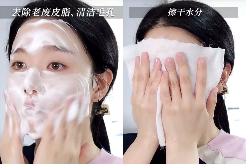 Tips I 闭口粉刺别乱挤！韩国皮肤科医生分享“生理食盐水”3步搞定护肤 更多热点 图2张