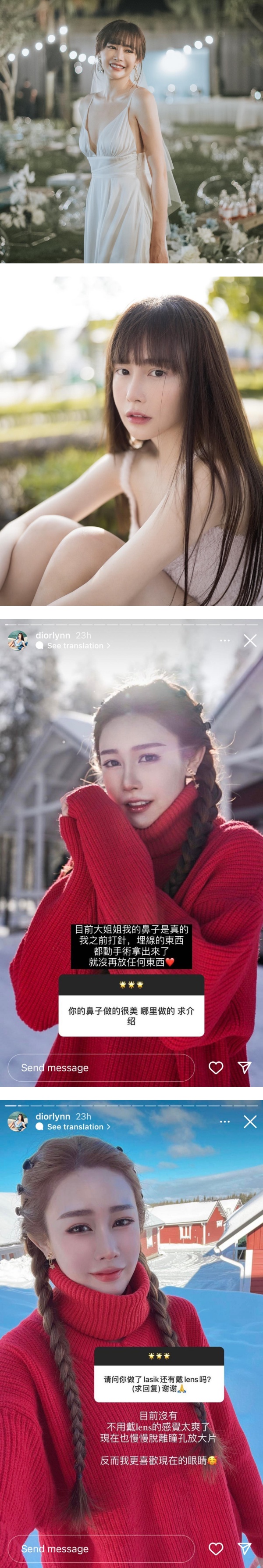 曾大方承认微整形+公开素颜照！Diorlynn自曝放弃“进厂保养” 回归自然美！ 娱乐资讯 图2张