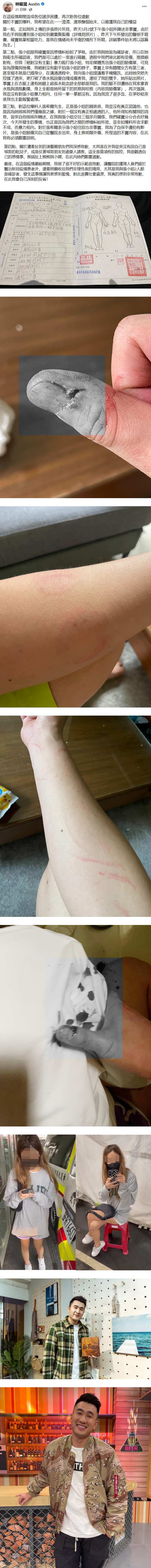 《终极三国》男星被爆殴打女性友人“满身是血”！ 求欢不成反掐脖威胁？ 娱乐资讯 图3张