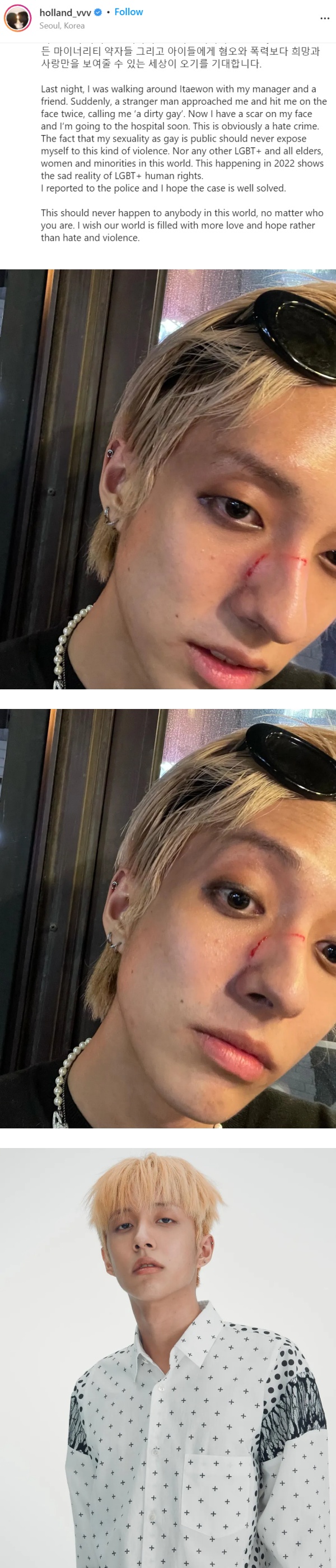 歌手公开出柜...在街上被打骂“脏GAY！” 贴血照 娱乐资讯 图1张
