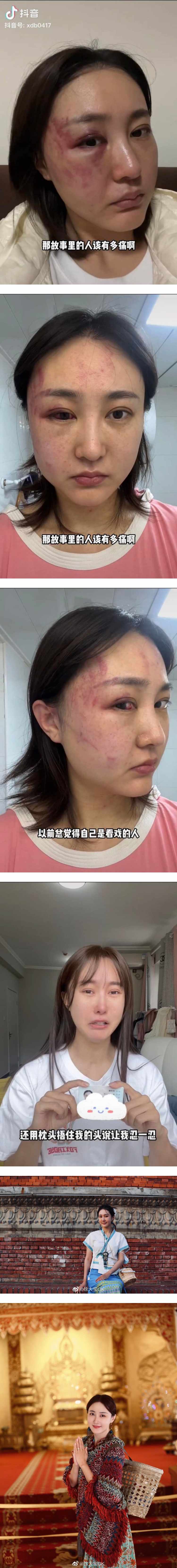 网红结婚半年被家暴4次！ 老公企图用枕头闷死她 娱乐资讯 图2张