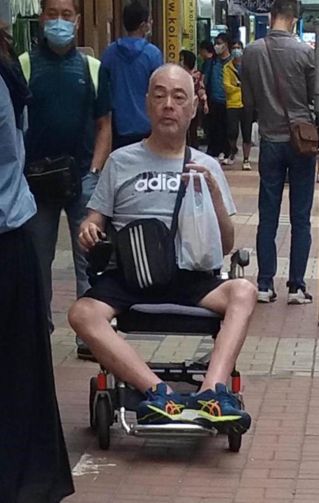 68岁张伟文曝养老院内自残、向隔壁床扔杂物！暴瘦至双腿见骨 娱乐资讯 图3张
