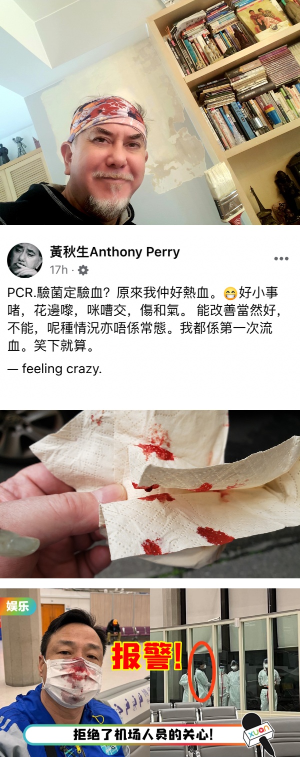 第二个王喜？黄秋生自曝做PCR 狂喷鼻血！“原来我好热血” 娱乐资讯 图2张