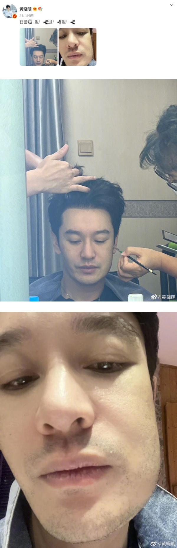 黄晓明自曝圆脸肿成猪头！网嘲：方晓明 娱乐资讯 图1张