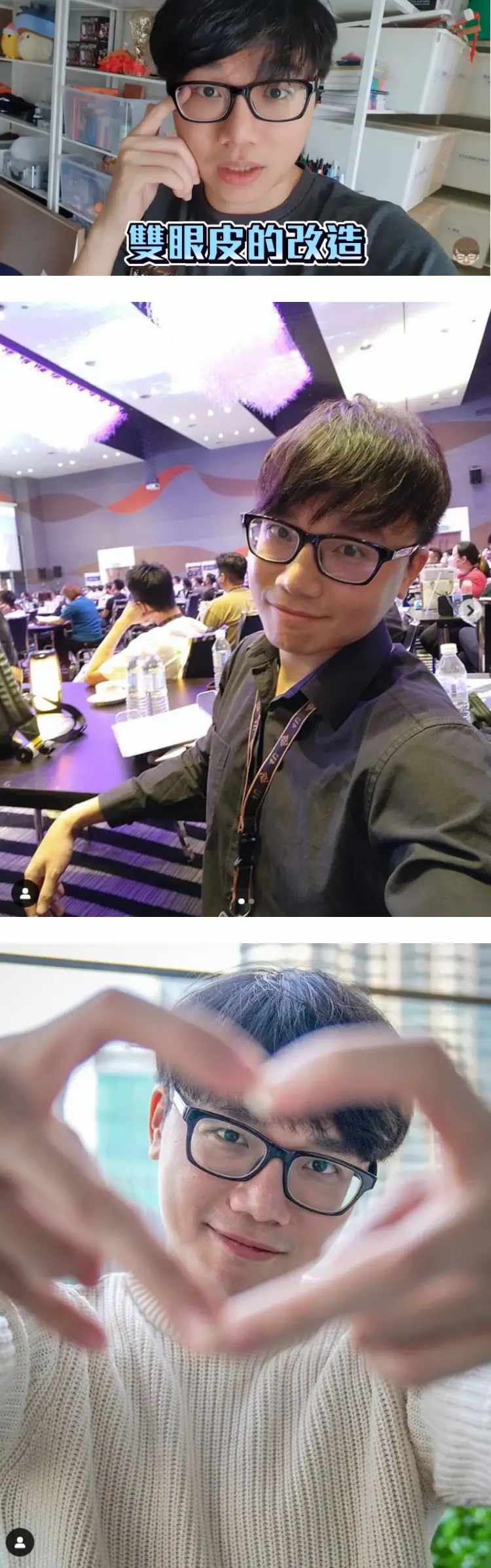 5位大方承认整容的马来西亚网红！ 她从脸部到臀部都曾动过刀 娱乐资讯 图2张