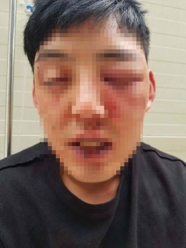 韩国18禁恋综“肌肉猛男”曝丑闻！把人揍到鼻青脸肿...“没道歉”挨告 娱乐资讯 图2张
