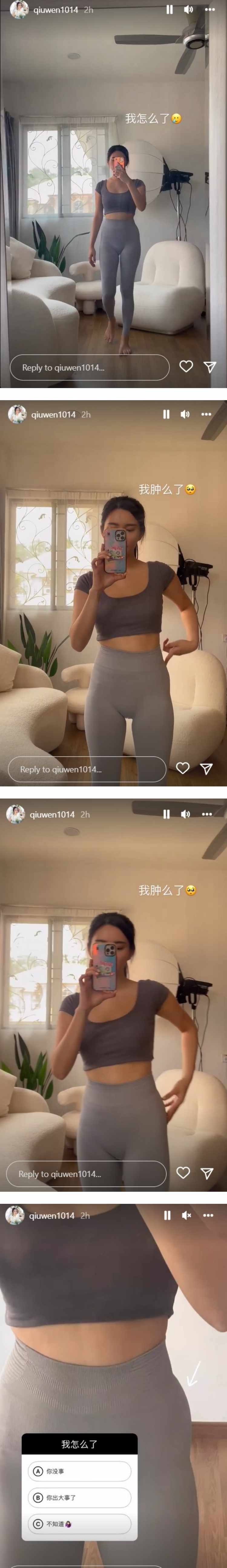 秋雯胯部突肿一大包！ 吓坏：有一点害怕 娱乐资讯 图2张