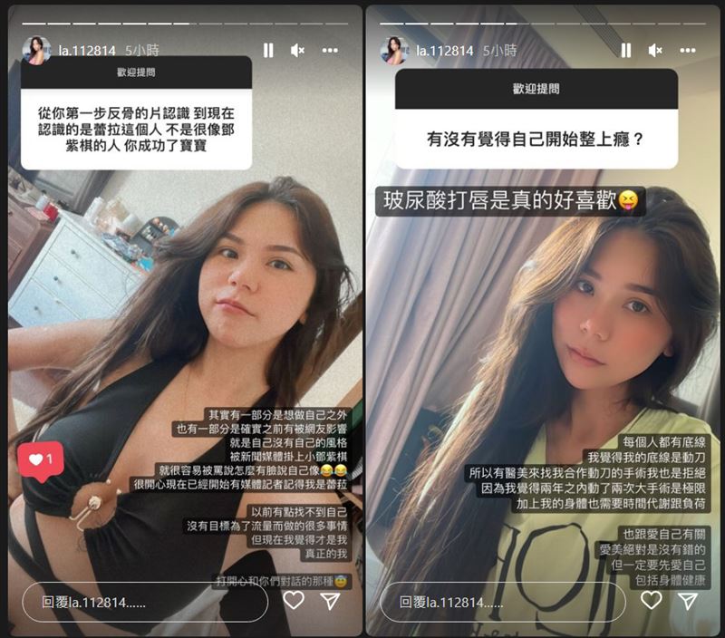 曾“为露而露”蕾菈隆乳后曝心境变了：以前有点找不到自己 时尚资讯 图2张