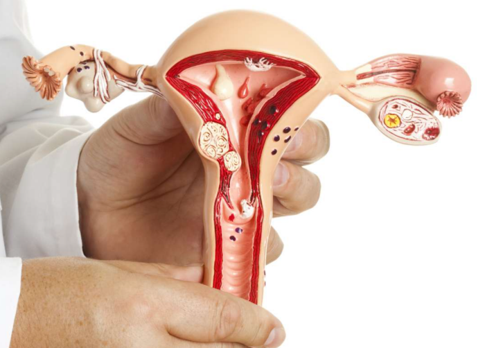 健康｜90、00后该注意了，女人最容易得的5种癌症你们可有了解？ 更多热点 图3张