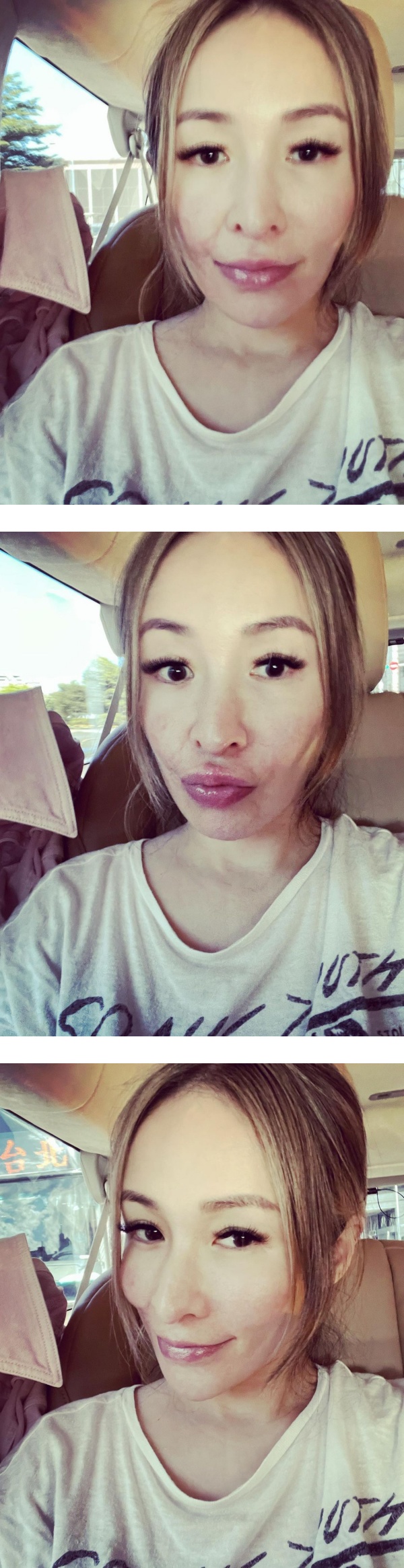 萧亚轩不再遮伤疤！素颜照获赞：怎样都很美 娱乐资讯 图1张