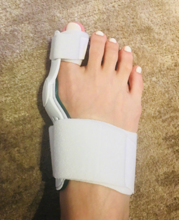健康｜杨丞琳脚拇趾外翻吓坏人，太严重还必须动手术？ 更多热点 图4张