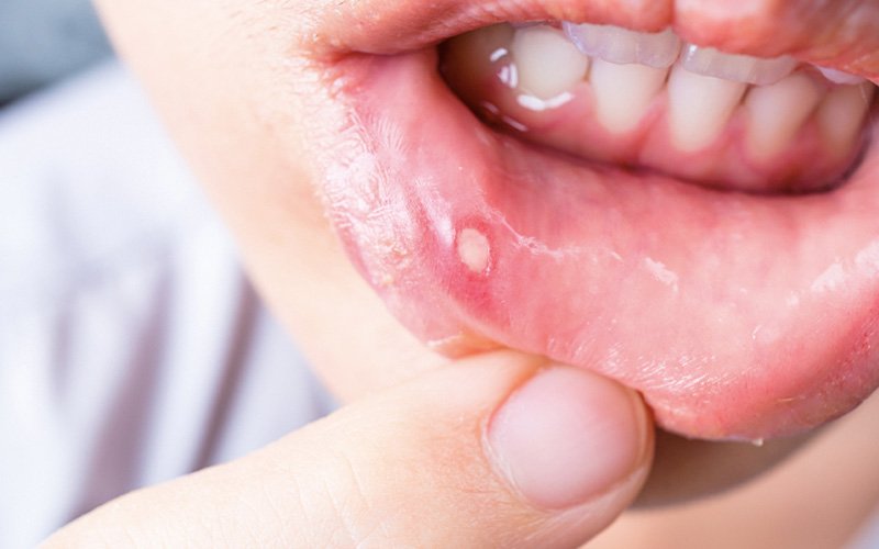 Tips I 鸡精不能乱补！尤其有这些慢性疾病的人士 更多热点 图5张