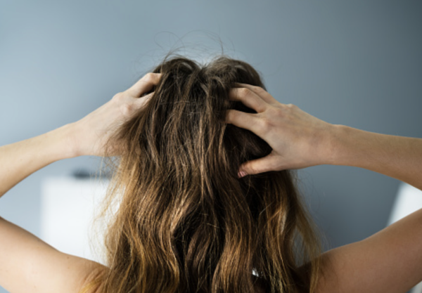 Tips｜防蚊叮、还抗痘，来认识女生都用来“顾门口”的茶树精油 更多热点 图2张