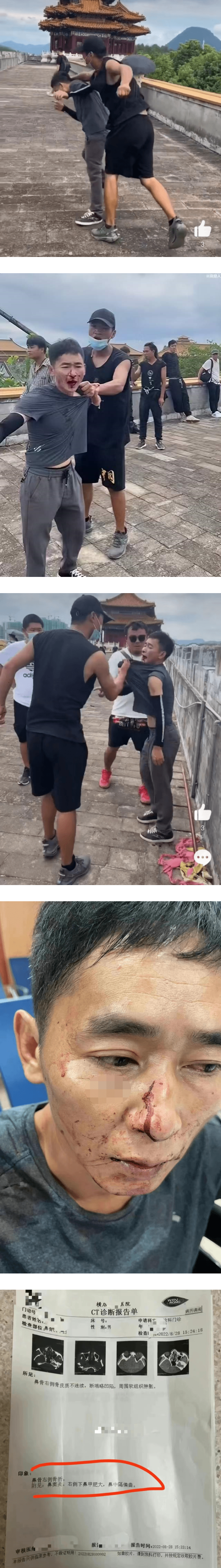 3剧组被曝打同一代拍！网质疑：故意找打讹钱？ 娱乐资讯 图1张